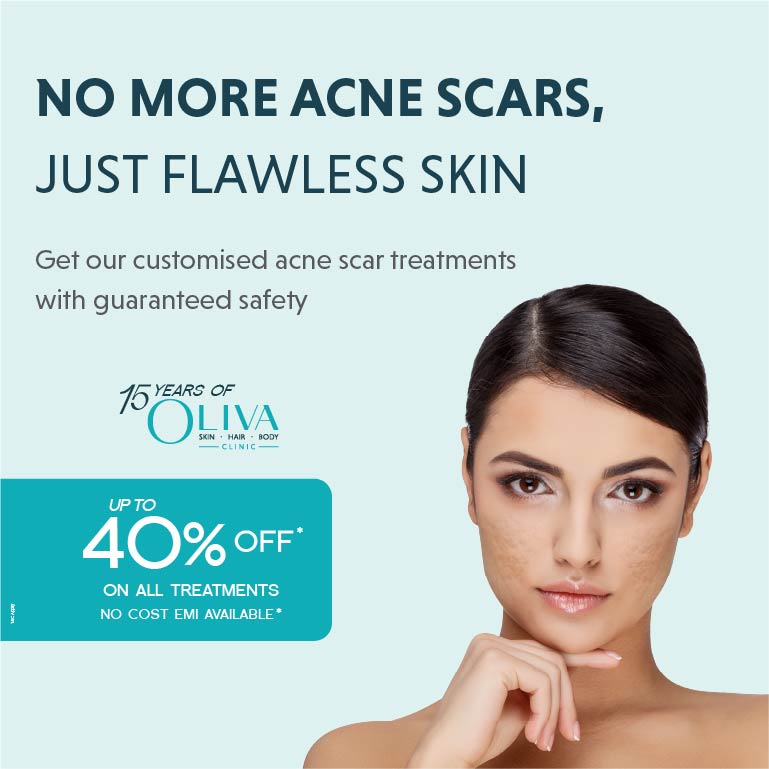 Acne Scar Treatment