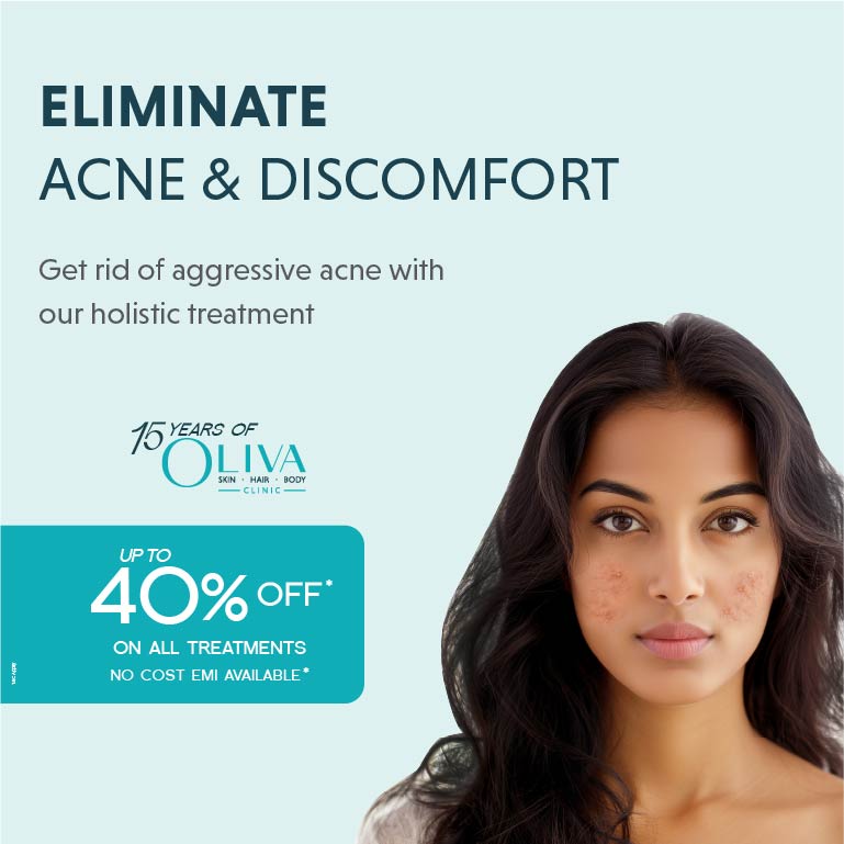 Acne Treatment In Kolkata