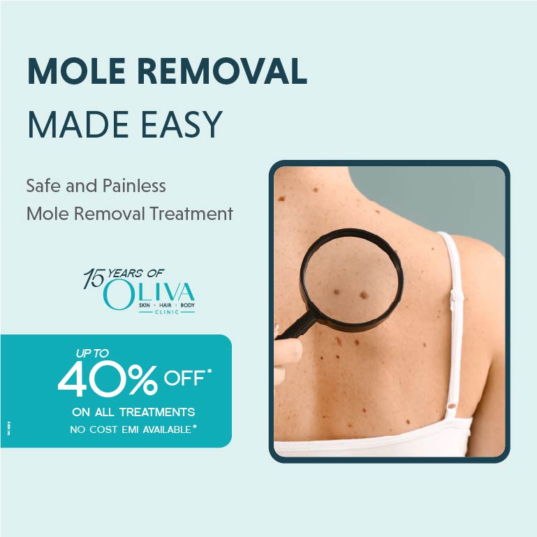 mole removal