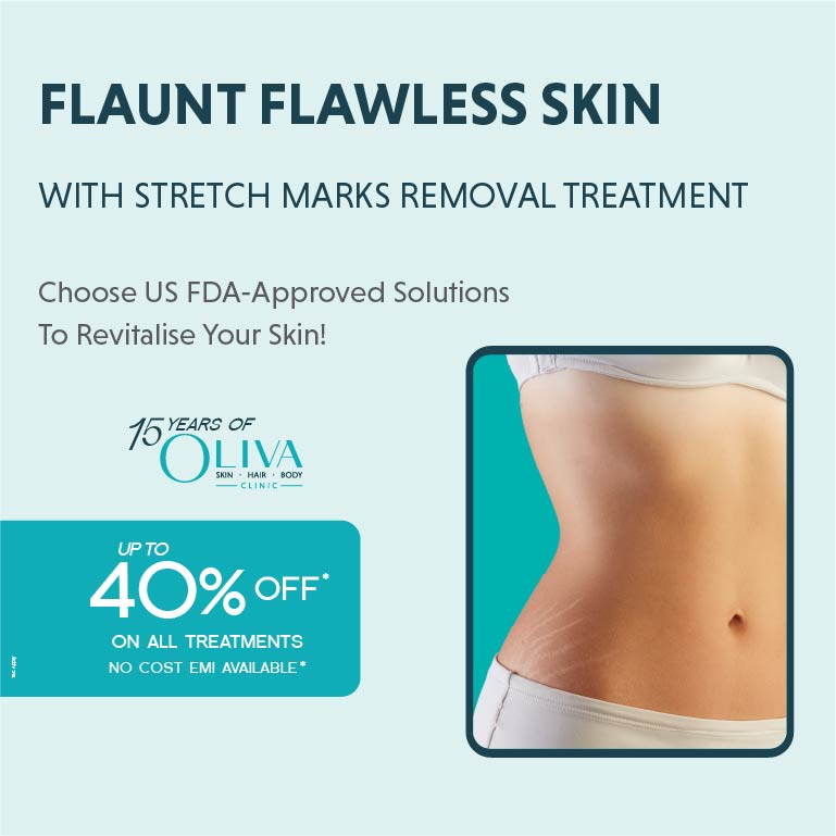 Stretch mark removal treatment 