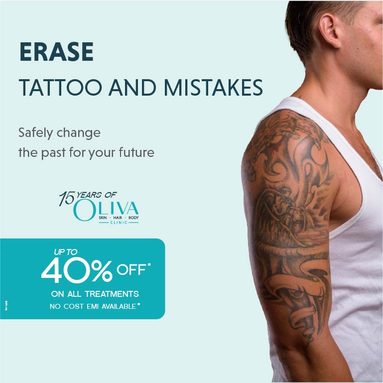 Tatto Removal treatment