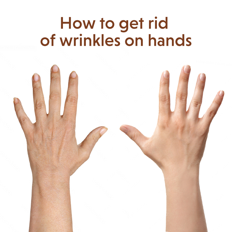 How To Get Rid Of Wrinkles On Hands