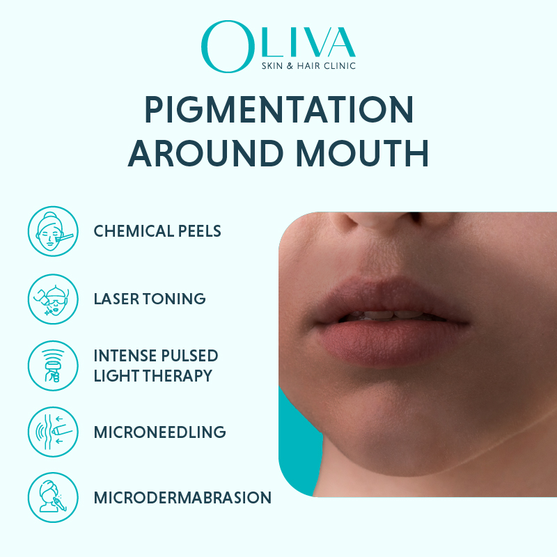 Hyperpigmentation Around Mouth