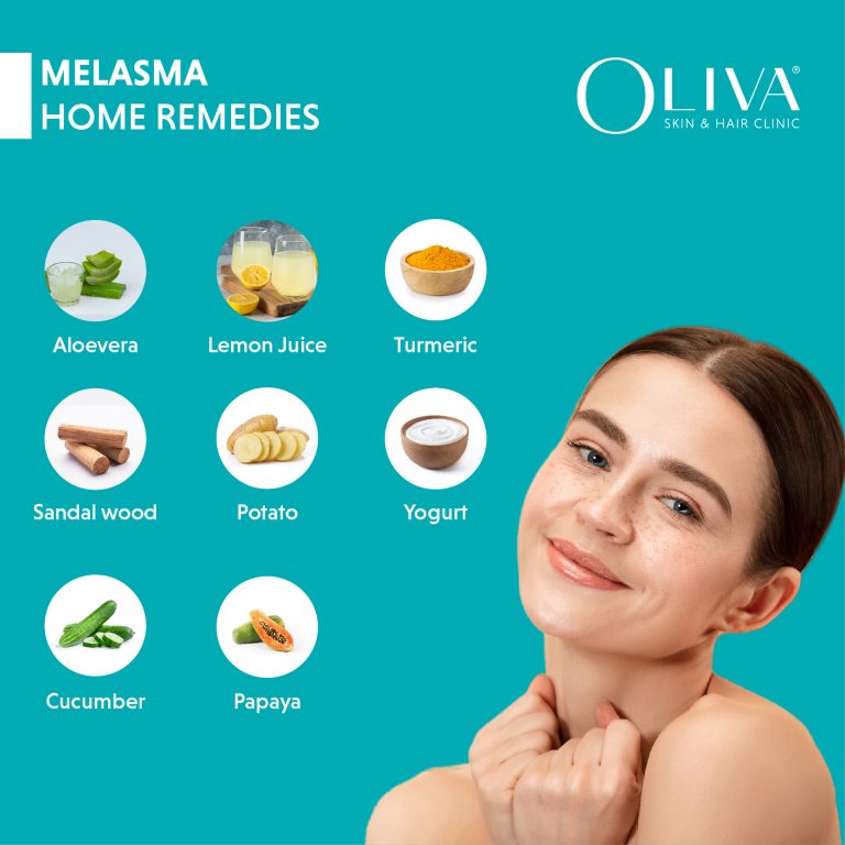 Home Remedies for Melasma