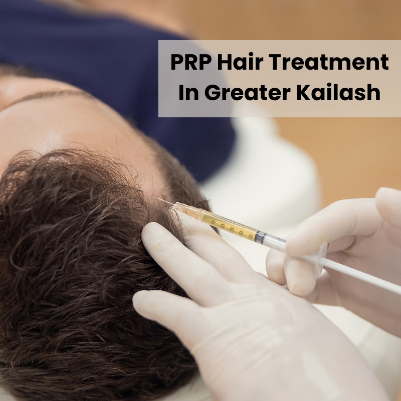 PRP-Hair-Treatment-In-Greater-Kailash