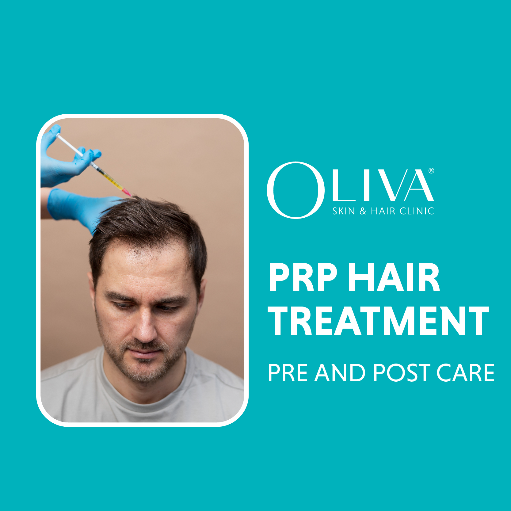 PRP-Hair-Treatment-Pre-Post-Care.