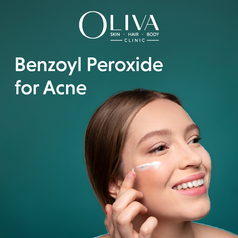 Benzoyl Peroxide For Acne