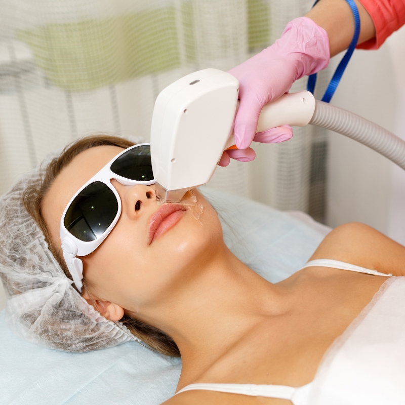 Does Laser Hair Removal Cause Cancer