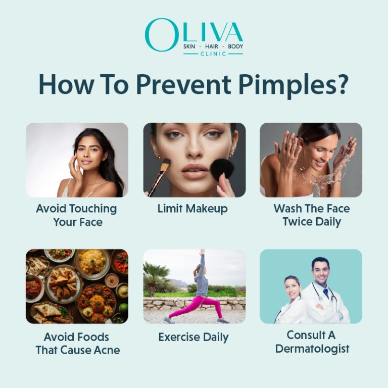 How To Prevent Pimples