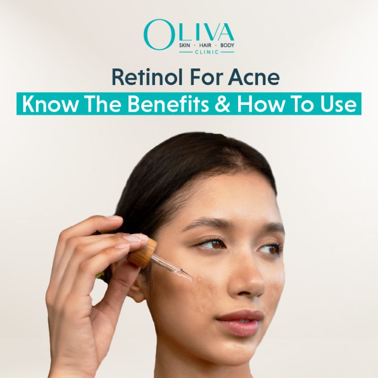 Retinol For Acne