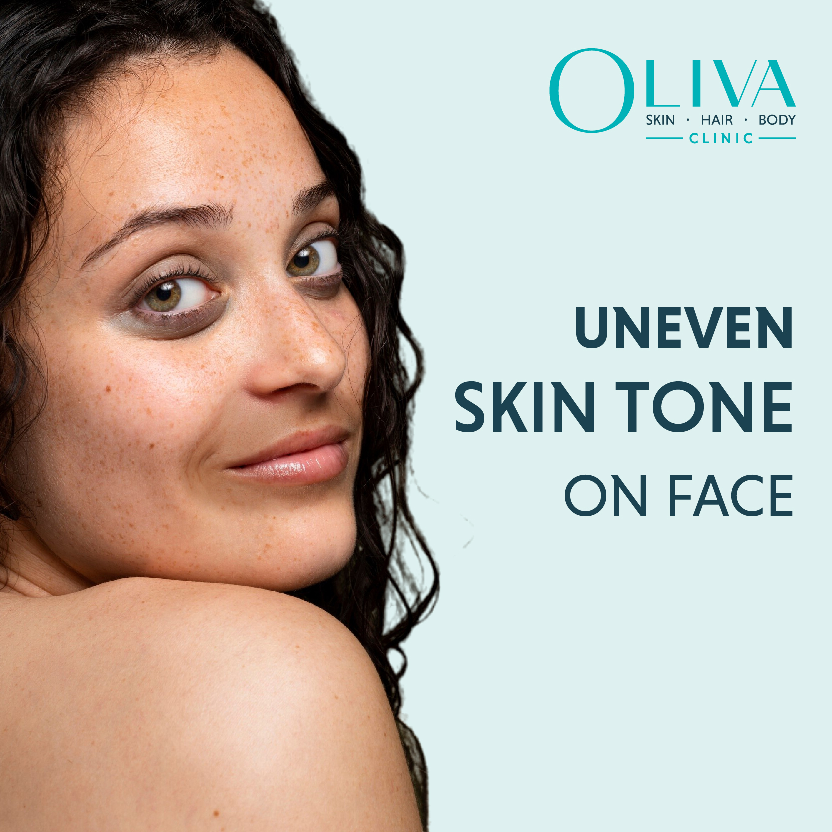 Uneven Skin Tone: Causes, Treatments, Home Remedies & Prevention