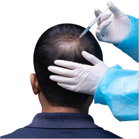 PRP Hair Treatment