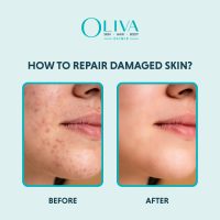 how to repair damaged skin