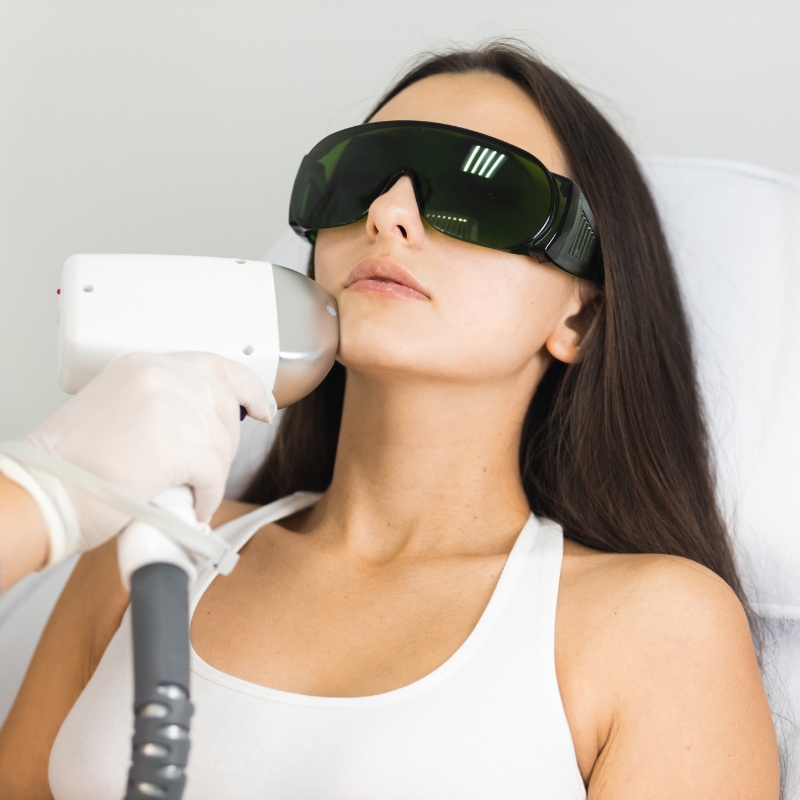 Laser Treatments For Face & Skin